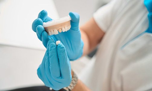 Dentist plucking a crown off of a plaster model 