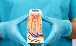 Dentist presenting model showing inside of decayed tooth
